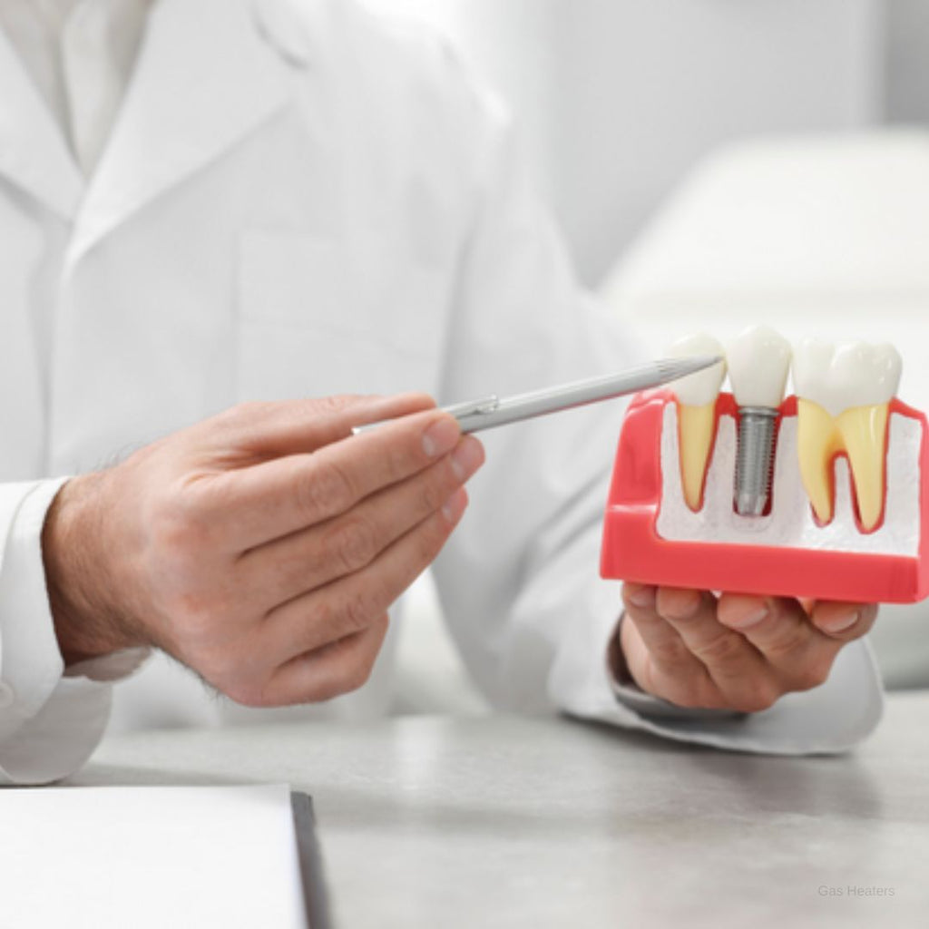 dental implants